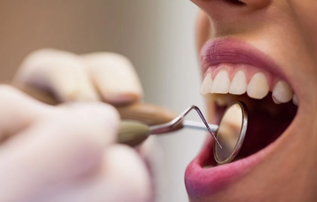 Cuidar tus dientes tras las vacaciones